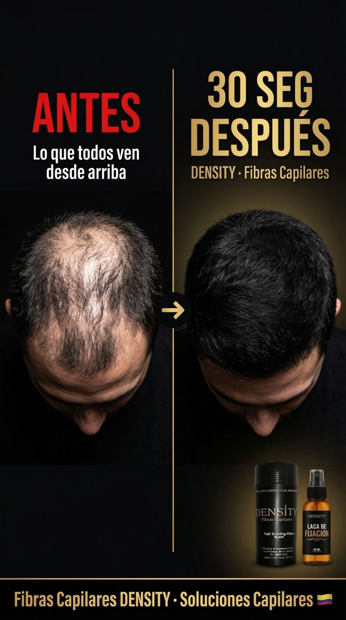 Kit Cabello Denso 3en1 - antes/despues